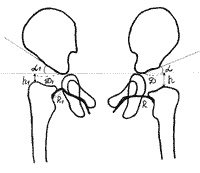Схема хильгенрейнера эрлахера