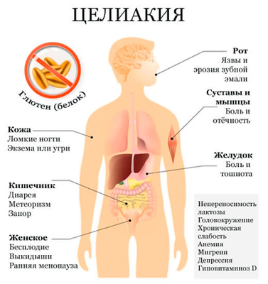 Головокружение тошнота частый стул