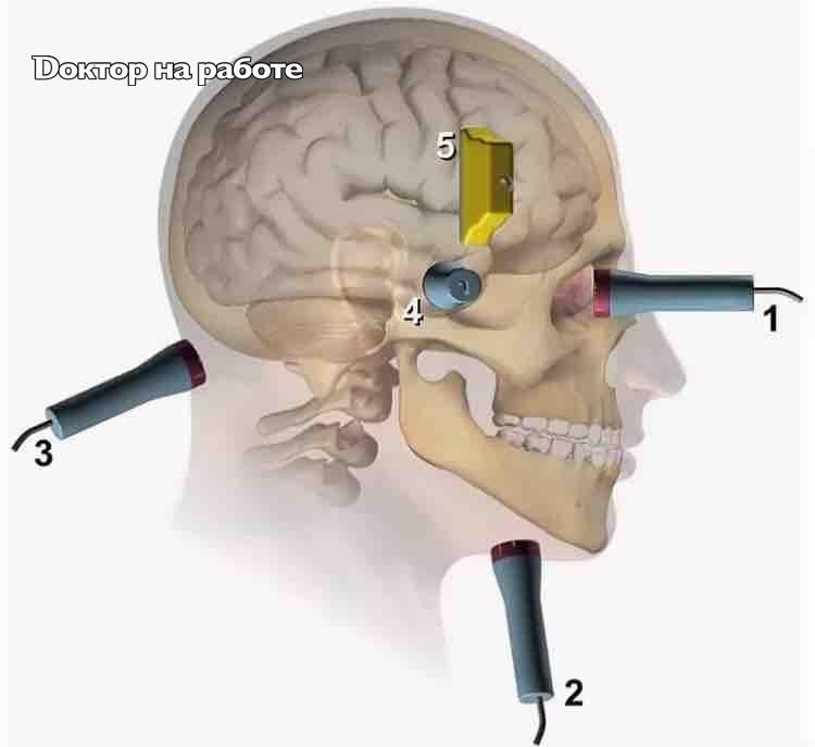 Узи мозга и шеи. Транскраниальная ультразвуковая допплерография. Транскраниальный ультразвуковой допплер. Транскраниальный датчик УЗИ. УЗИ внутричерепных сосудов датчик.