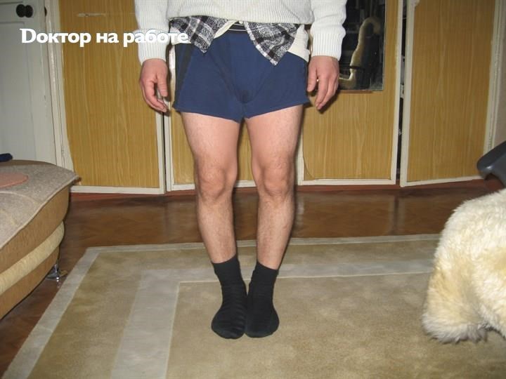 шорты с кривыми ногами. кривые ноги футболистов. кривые ноги у мужчин. коррекция голени варусной деформации. аппарат илизарова для увеличения роста.