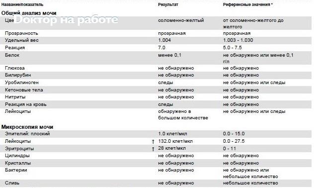 Показатели лейкоцитов в моче норма. Общий анализ мочи расшифровка у женщин норма в таблице 60. Показатели анализа мочи расшифровка норма у взрослых мужчин. Показатели анализов мочи в норме у женщин таблица. Эритроциты в моче (+2) мкл.
